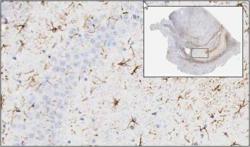 Histopathology evaluation with digital pathology and whole slide imaging in astrocytes or activated microglia